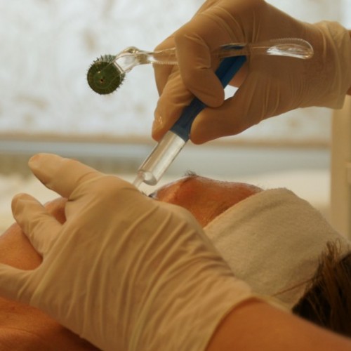 Kozmetikai kezelések